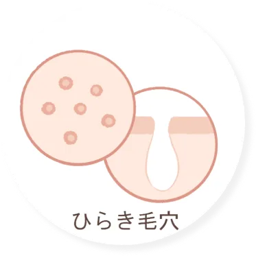 毛穴の開きが気になる