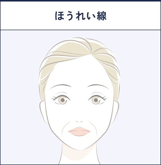 骨格や脂肪減少による凹みのイメージ