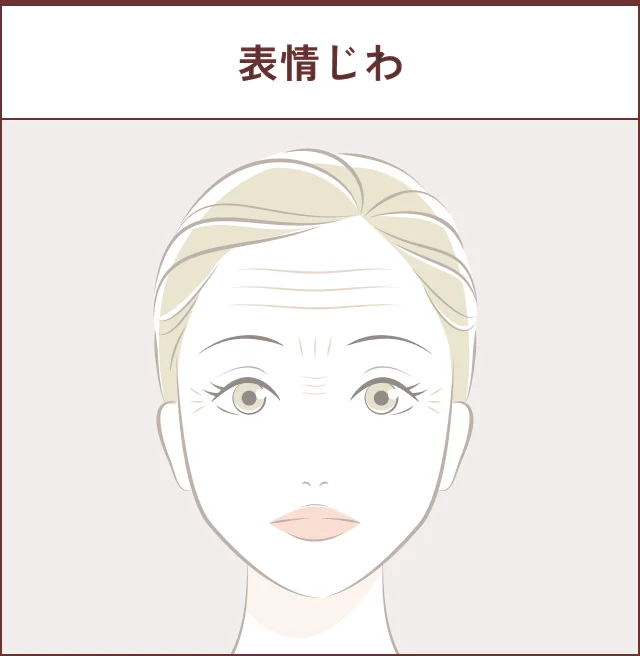表情筋によるしわのイメージ