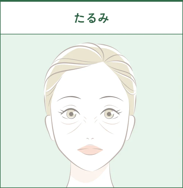 皮膚や脂肪のたるみのイメージ