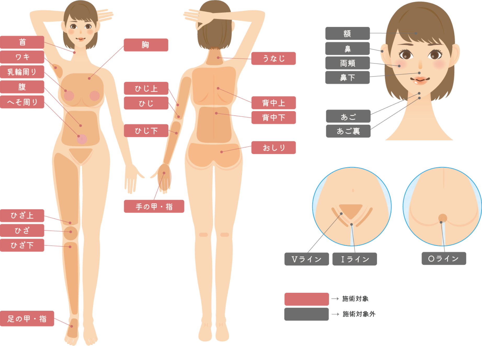全身脱毛バリューコースの治療対応各部位の図解