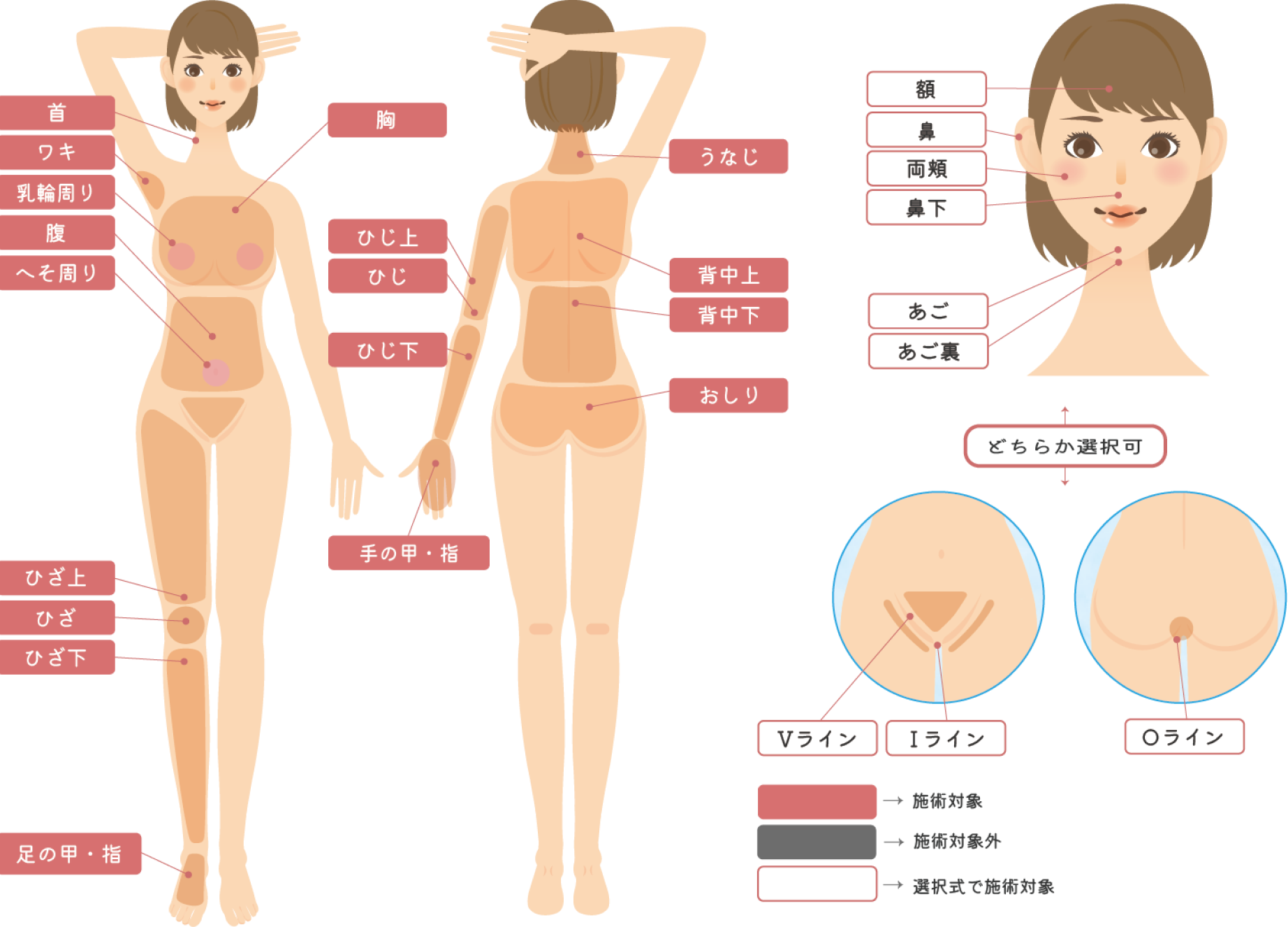 全身脱毛セレクトコースの治療対応各部位の図解
