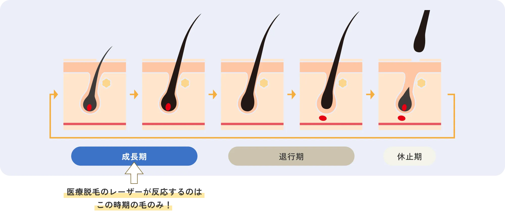 毛根の説明図解