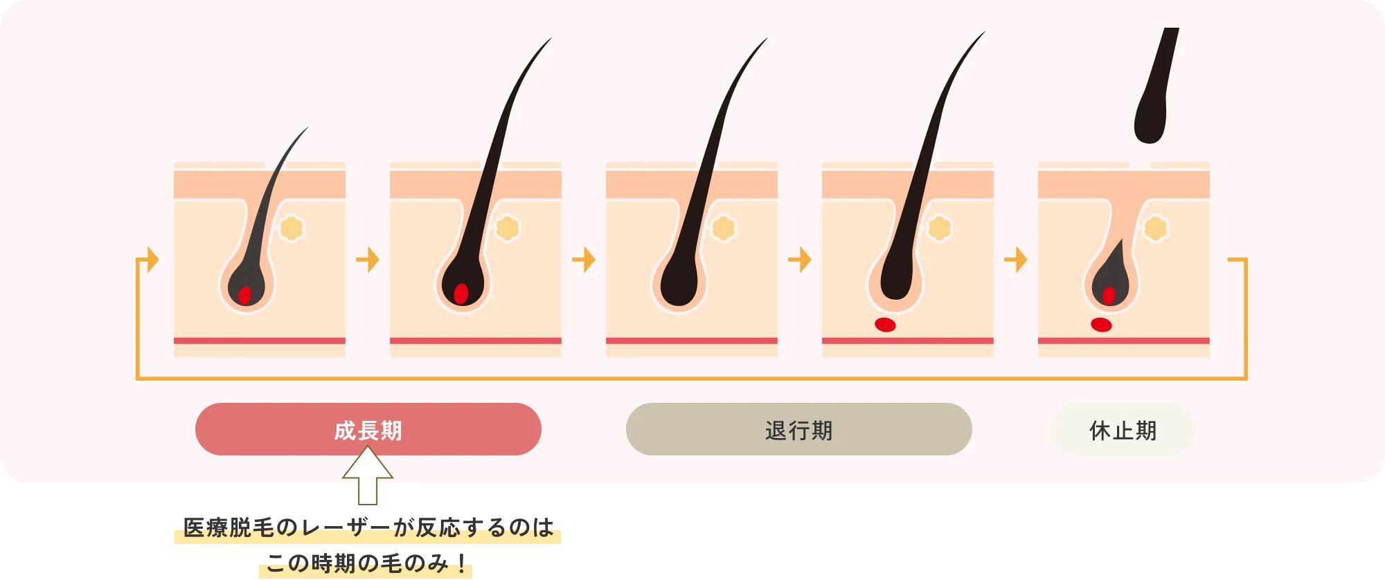 毛根の説明図解