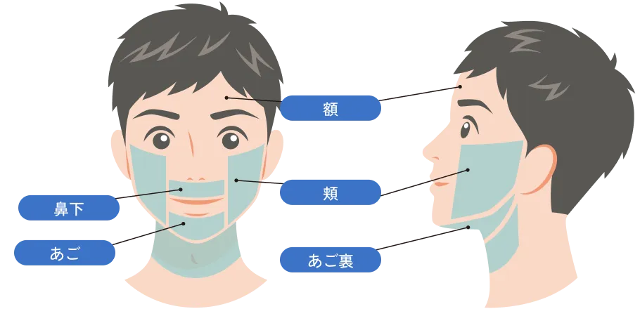 下顔面の施術部位イラスト（鼻下・頬・あご・あご裏）