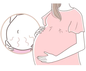 妊娠線を相談したい方へ