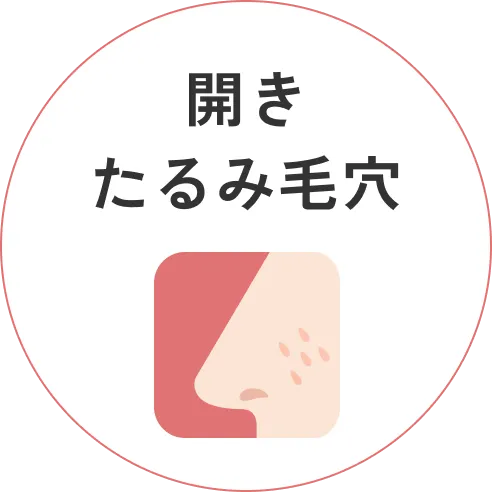 開き・たるみ毛穴