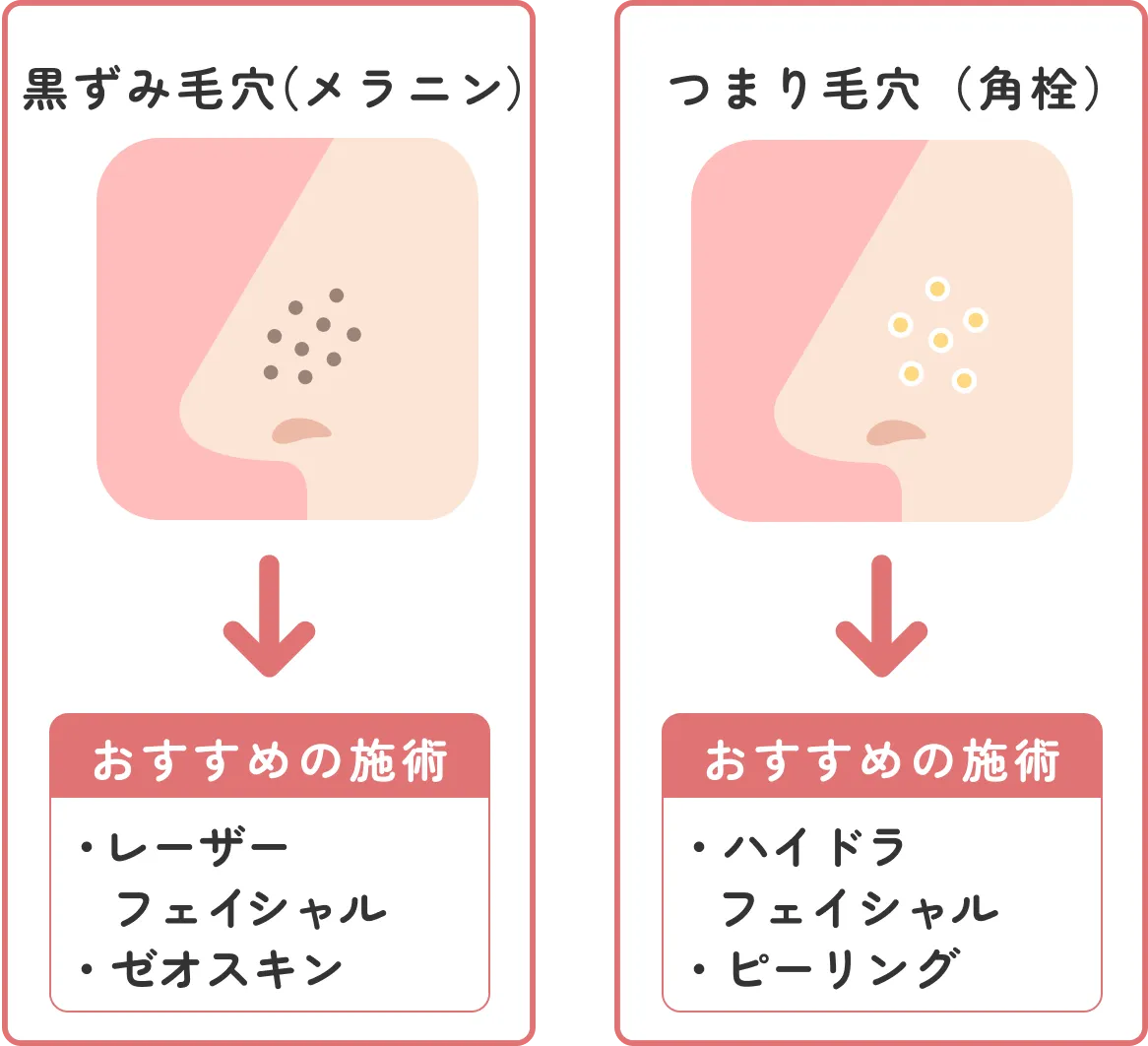 黒ずみ毛穴・つまり毛穴のおすすめ施術
